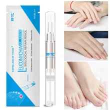 Load image into Gallery viewer, 3ML(60 drops) Anti fungal herbal treatment nail pen for fungal  Infection